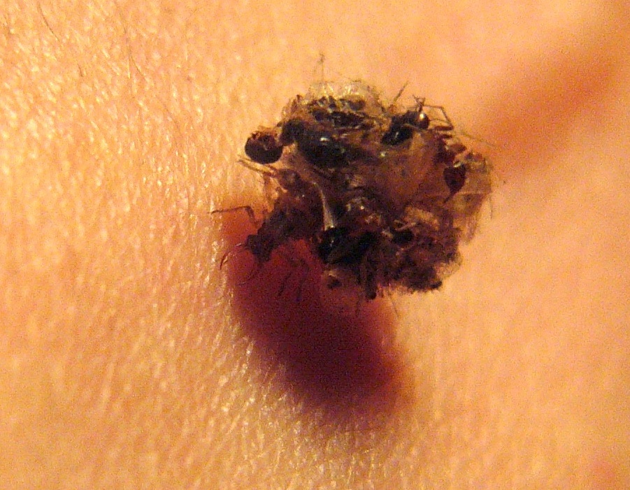 Larva di Pseudomallada sp.